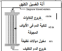 غسيل الكلى in Arabic Language