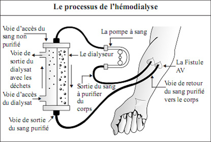 Kidney and its Function in spanish Language