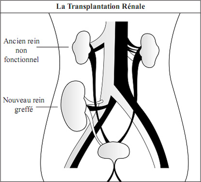 Kidney and its Function in French Language