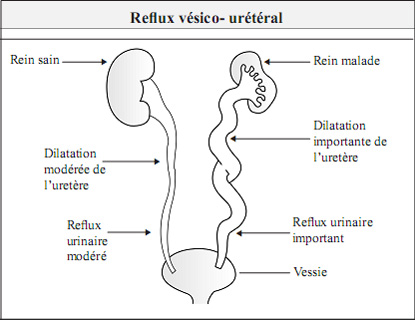 Kidney and its Function in French Language