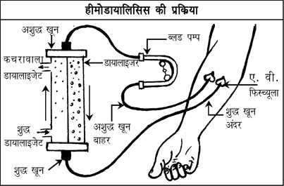 Kidney In Hindi