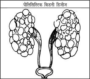 Kidney In Hindi