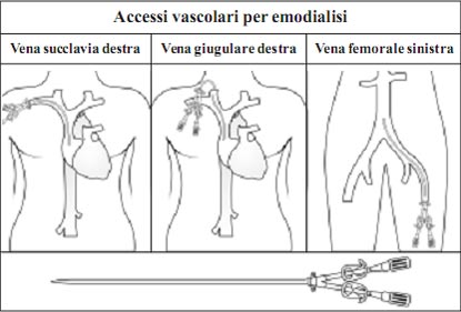 Kidney and its Function in Italian Language