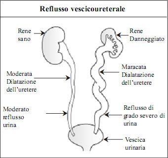 Kidney and its Function in Italian Language