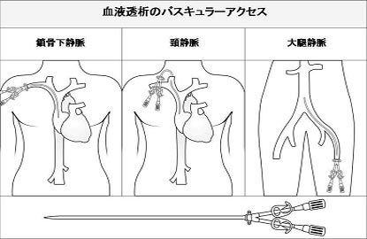 Kidney in Japanese