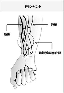 Kidney in Japanese