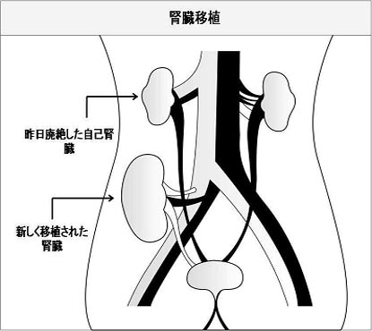 Kidney in Japanese