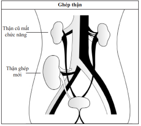 Urine Formation