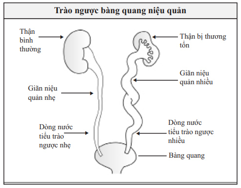 Urine Formation