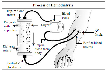 Dialysis in spanish Language