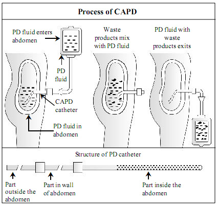 Dialysis in spanish Language